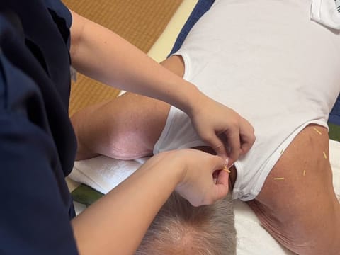 はり(鍼)による施術の様子